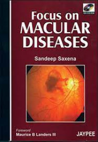 Focus on macular diseases